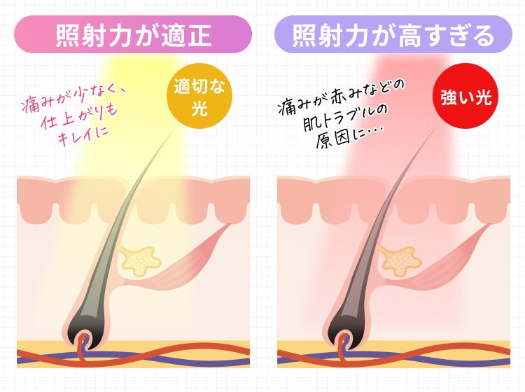 照射力が適正・照射力が高すぎる