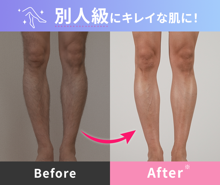 BA画像